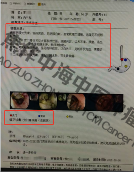 1784777864316412.png 贲门癌王二江1.png