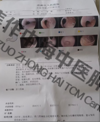 1784777888280618.png 贲门癌王二江2.png