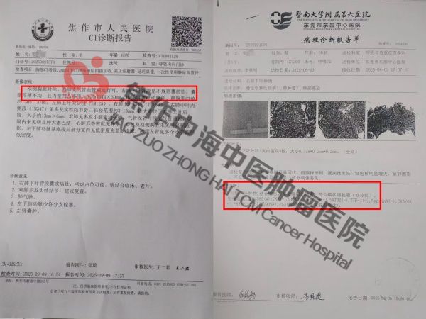 肺癌邓孟柏1.jpg