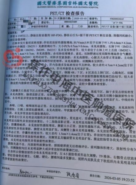 肺癌范金全1.jpg