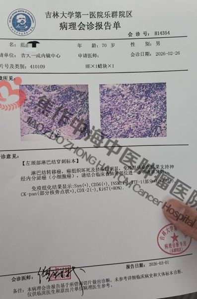 肺癌范金全2.jpg
