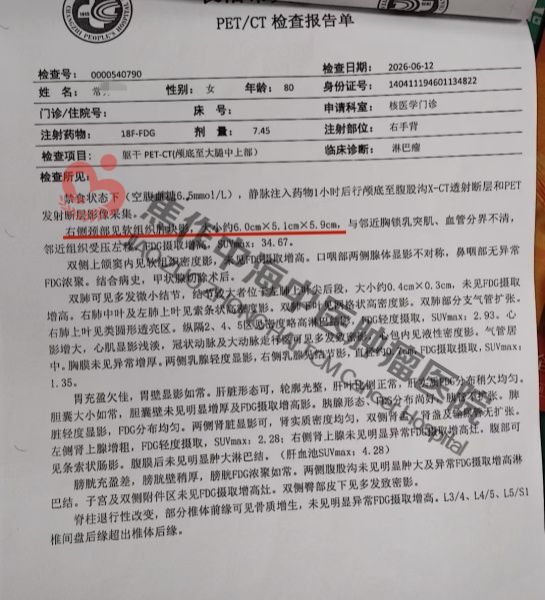 1786096221687696.jpg 淋巴瘤常秀梅1.jpg