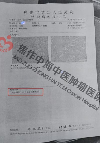 1786096560686438.jpg 口腔癌谷凤琴1.jpg