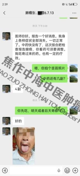 1786174474833807.jpg 肺癌张永启.jpg