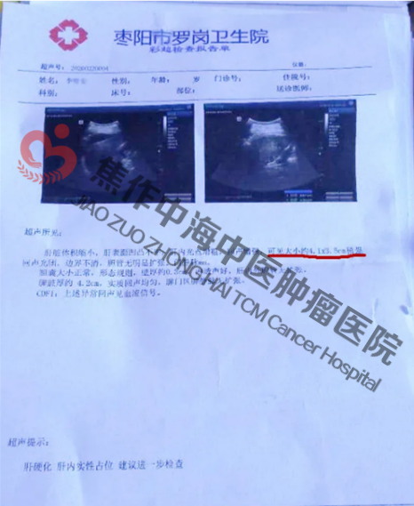 肝癌李2.png