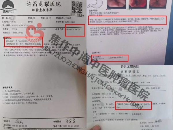 1787821896981570.jpg 贲门癌郝付朝1.jpg