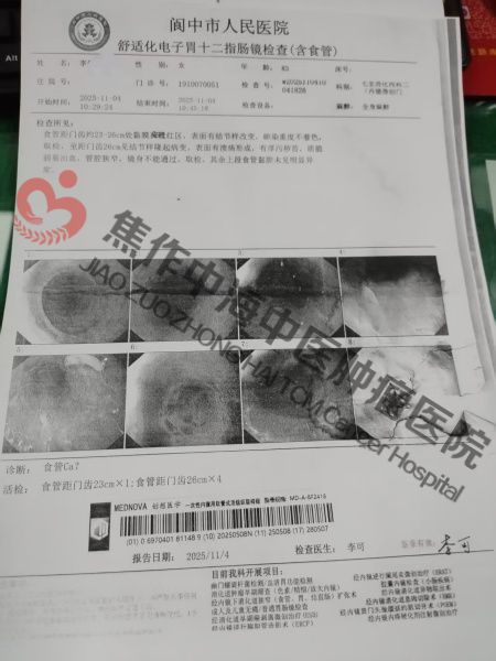 1787822337361972.jpg 食道癌李先知1.jpg