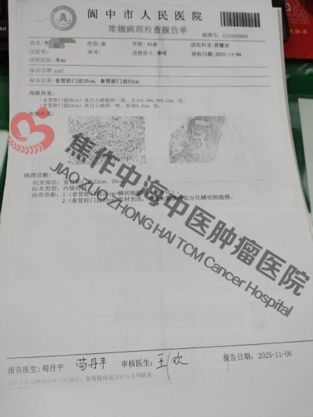 1787822356762899.jpg 食道癌李先知2.jpg
