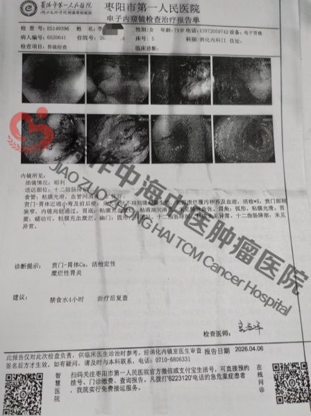 1787822681560735.jpg 胃癌李跃梅1.jpg