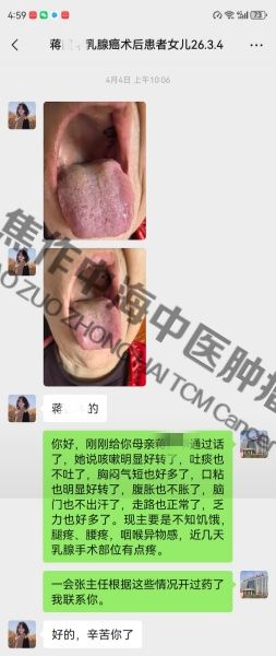 1790154214720869.jpg 乳腺癌蒋国华.jpg