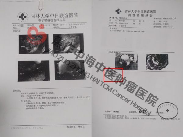 下咽癌杨庆海1.jpg