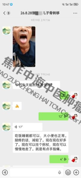 1791009808648438.jpg 骨癌张金忠.jpg