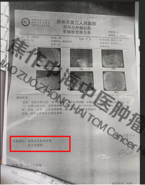 1792048263455050.png 胃癌买英朝1.png
