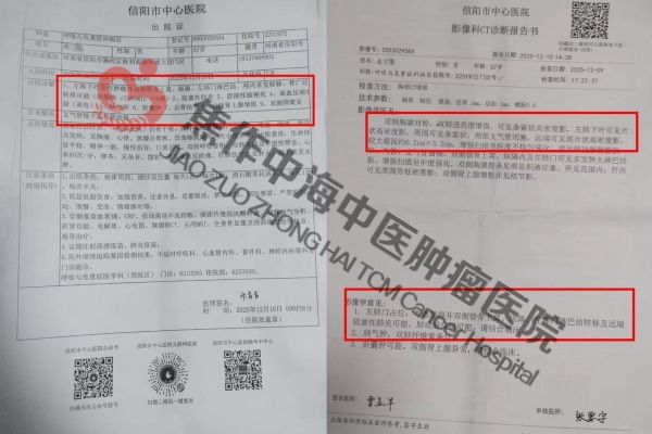 1792639670515790.jpg 肺癌高付新1.jpg